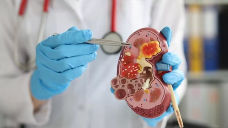 13_03_2025-kidney_damage_23899325